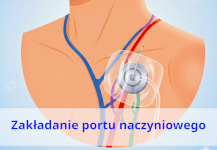 port naczyn mini